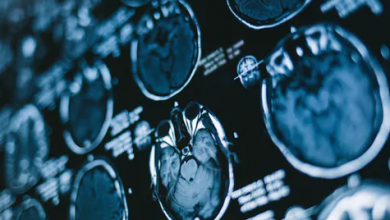 brain Voice Of Freedom